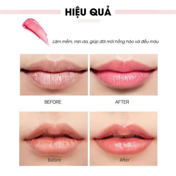 bo dac tri tham moi alibest 1 hop kem va 1 serum anh 01