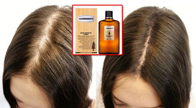 Nineless Breworks Hair Growth Tonic 100ml – SoKoSkins